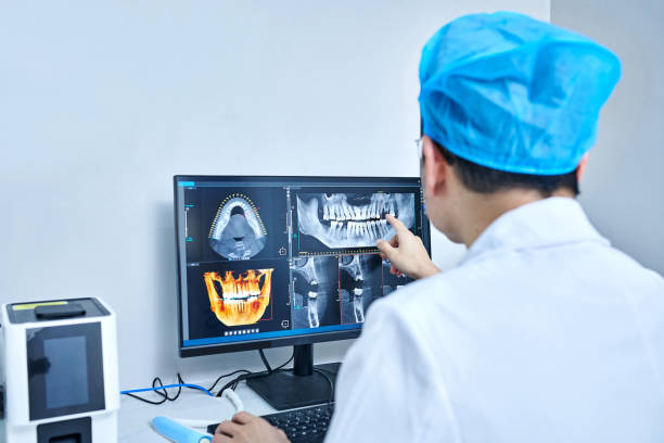 Best Dental Abscess Treatment in Fontana, CA