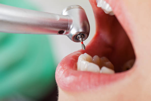 Best Emergency Treatment for Jaw Pain or Injury in Fontana, CA